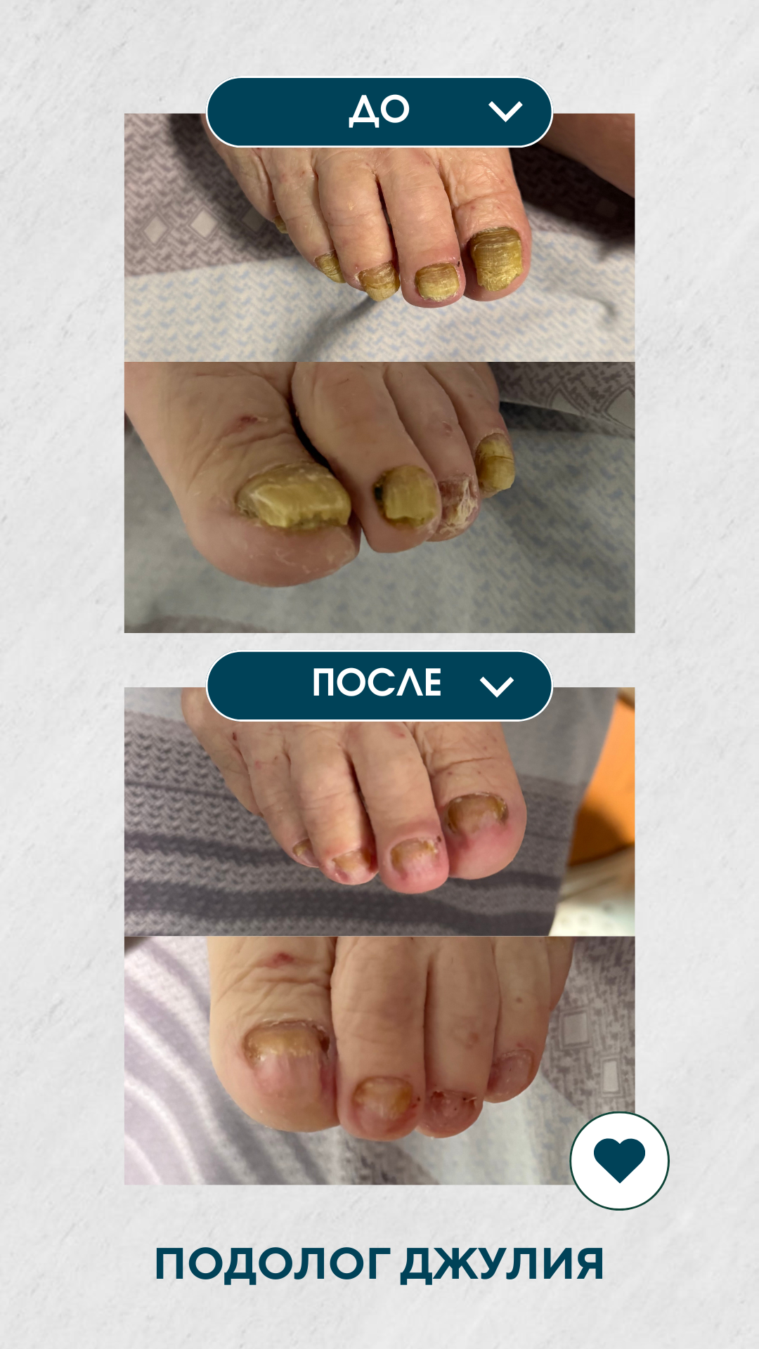 Благотворительный выезд в пансионат. Подолог г. Хабаровск — центр здоровой стопы «FOOTTIME»