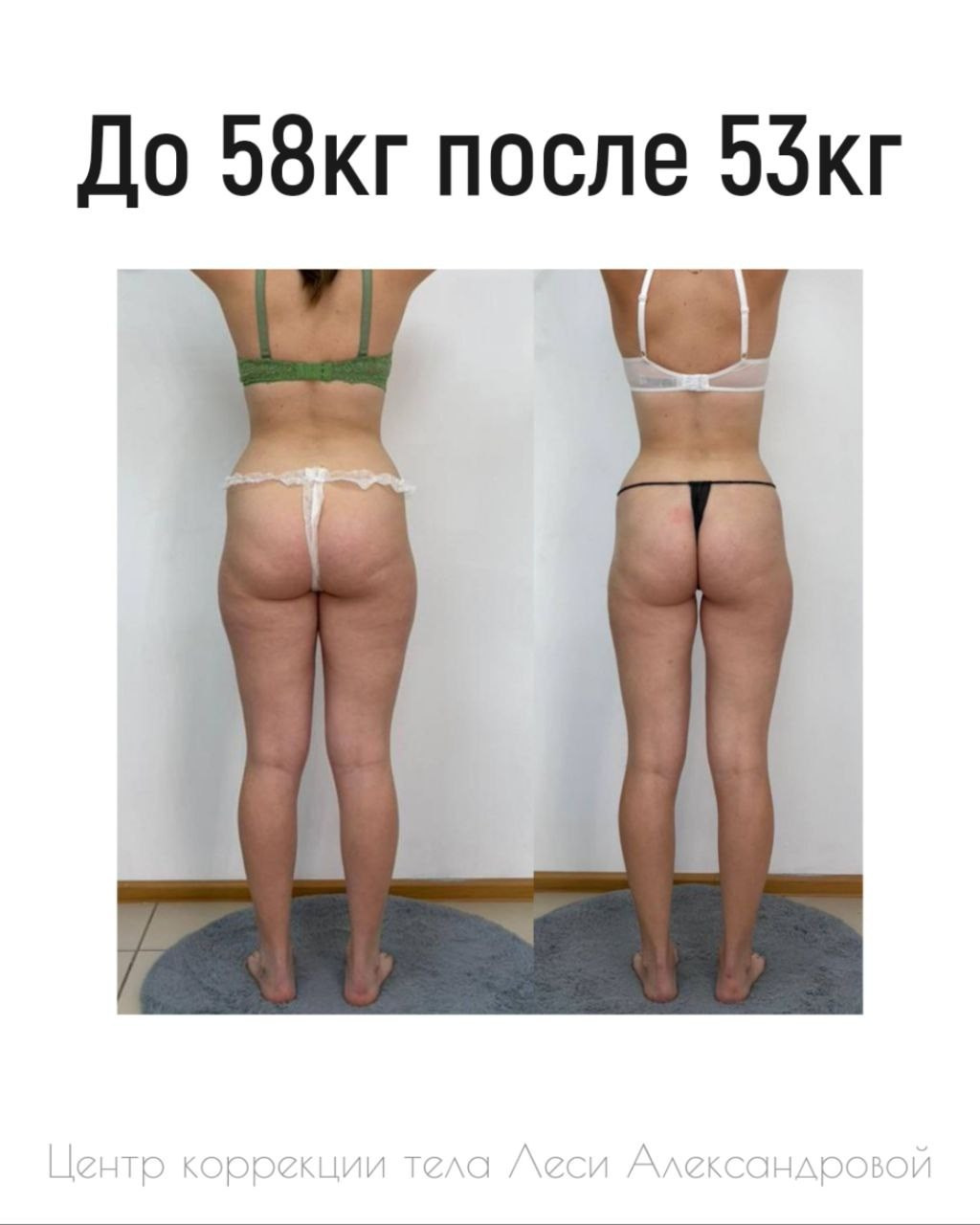 Результаты. Центр Коррекции Тела в городе Чехов