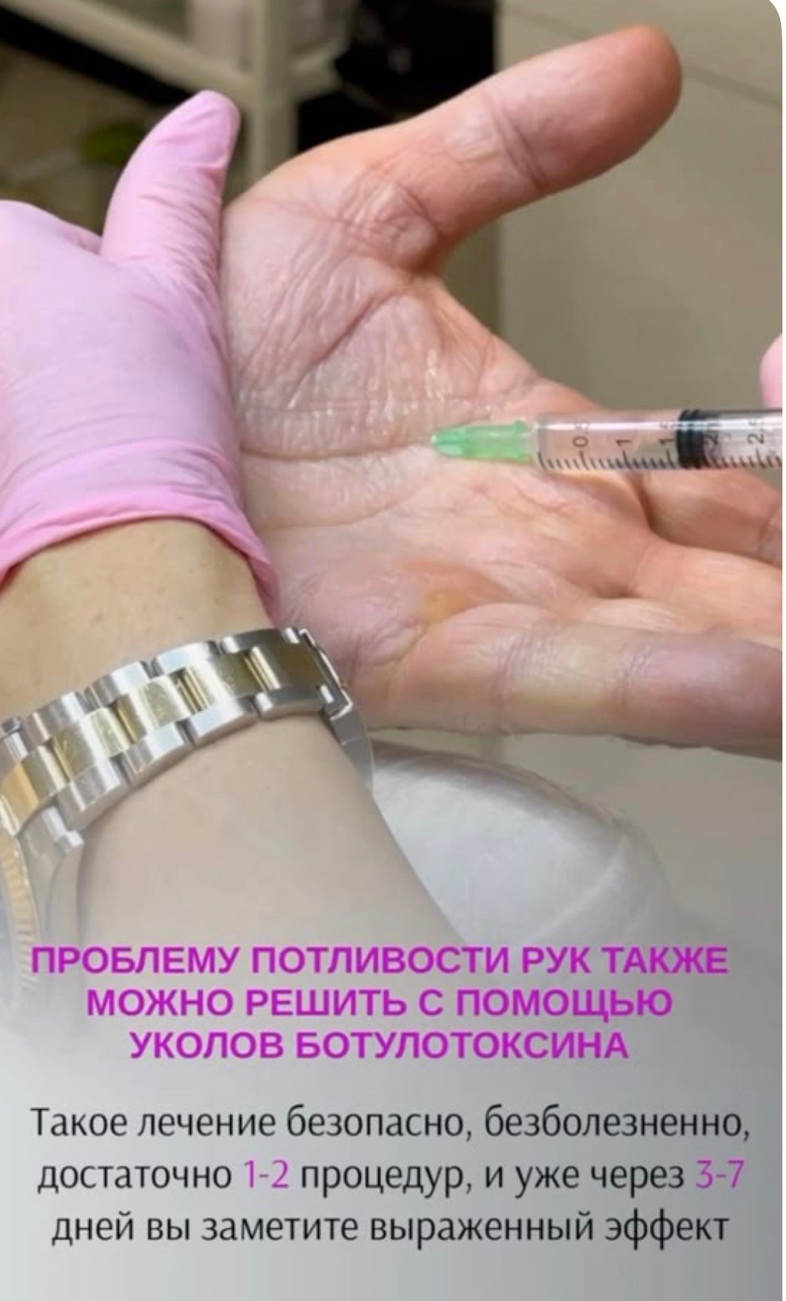 Лечение гипергедроза. Косметолог в Краснодаре