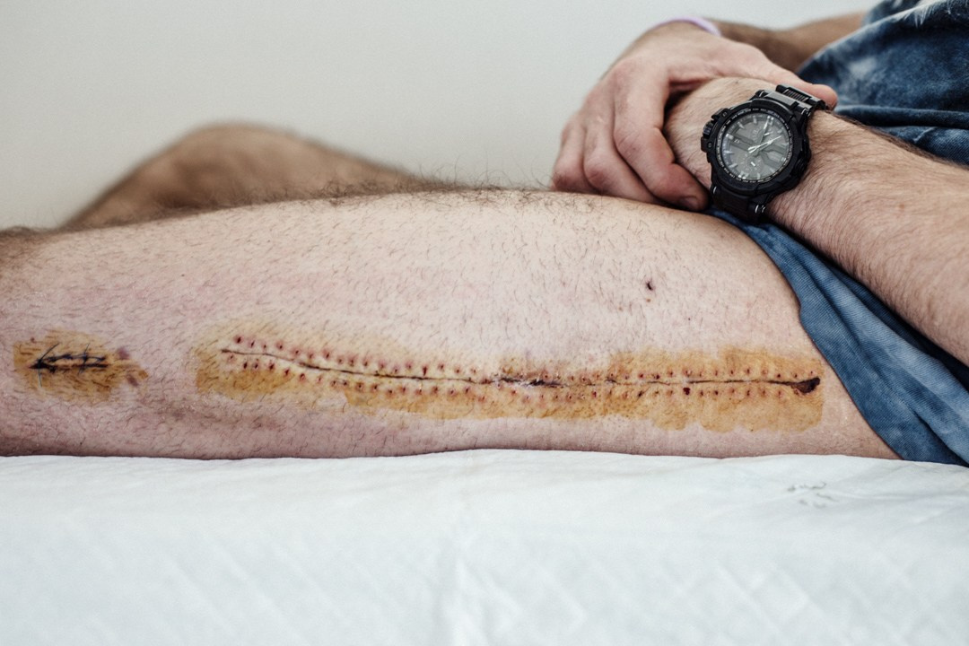 Cherrybomb Pavel Alekhin Doc. Bivol images