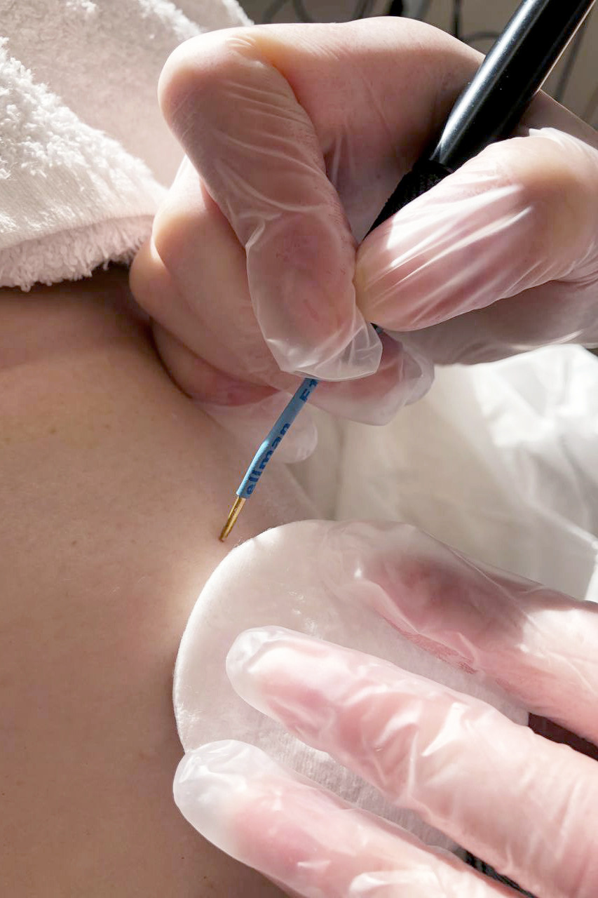 Съемка для клиники эстетической медицины. Фотографы в Тюмени Андрей и Лидия Войвод