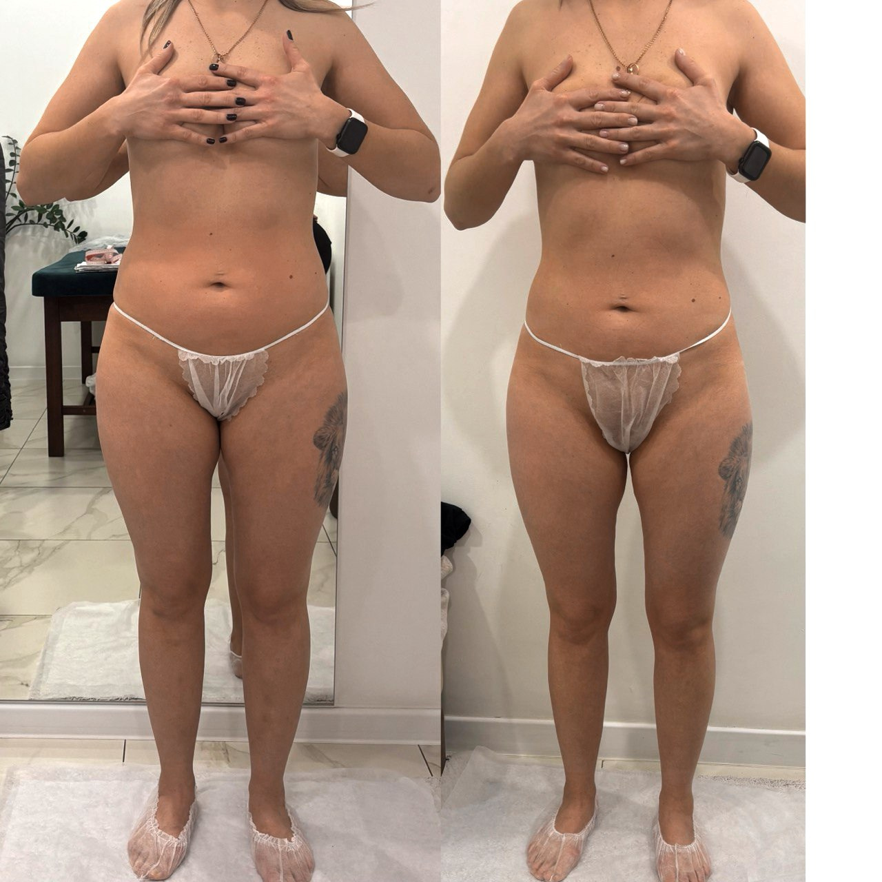 Аппаратный массаж, эндосфера, ручной массаж. Студия перманентного макияжа, косметологии и массажа SYMMETRY в Москве, м. Киевская