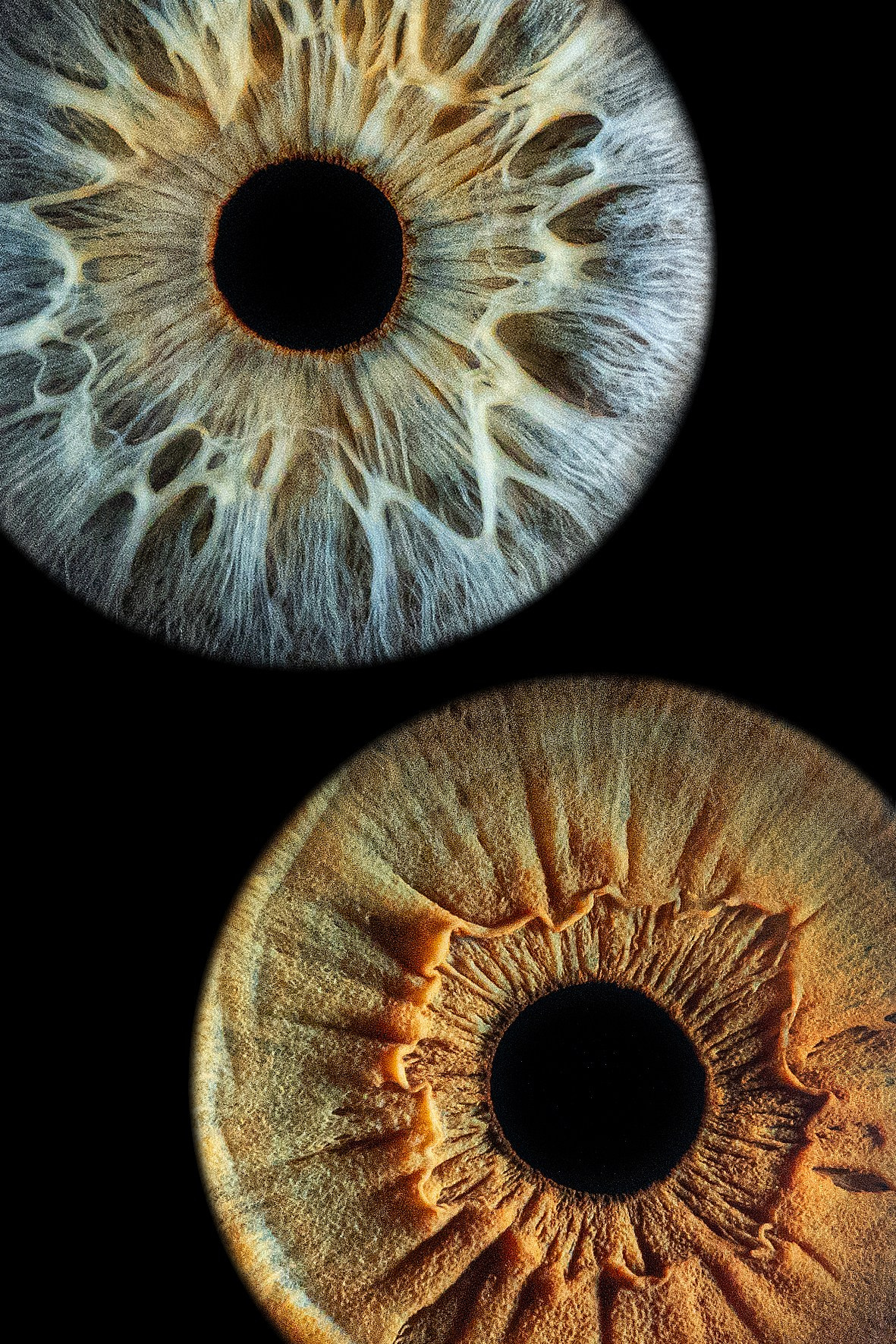 Примеры работ. Мой глаз