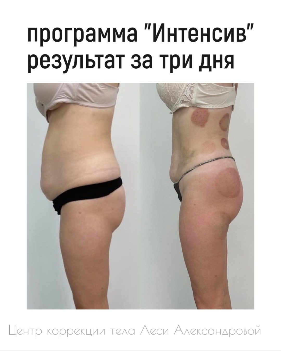 Результаты. Центр Коррекции Тела в городе Чехов