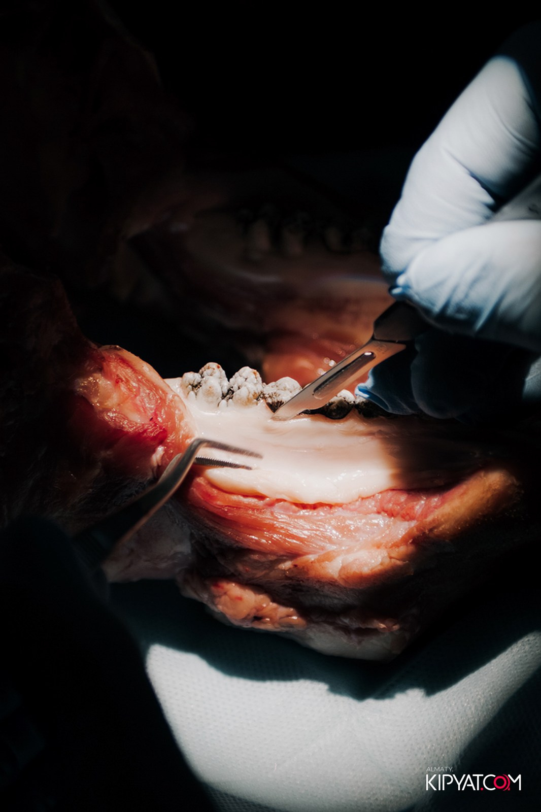 КУРС ДЛЯ СТОМАТОЛОГОВ ОСЛОЖНЕНИЯ В ХИРУРГИЧЕСКОЙ ПРАКТИКЕ КТО ВИНОВАТ И ЧТО ДЕЛАТЬ. КИПЯТКОМ АЛМАТЫ!