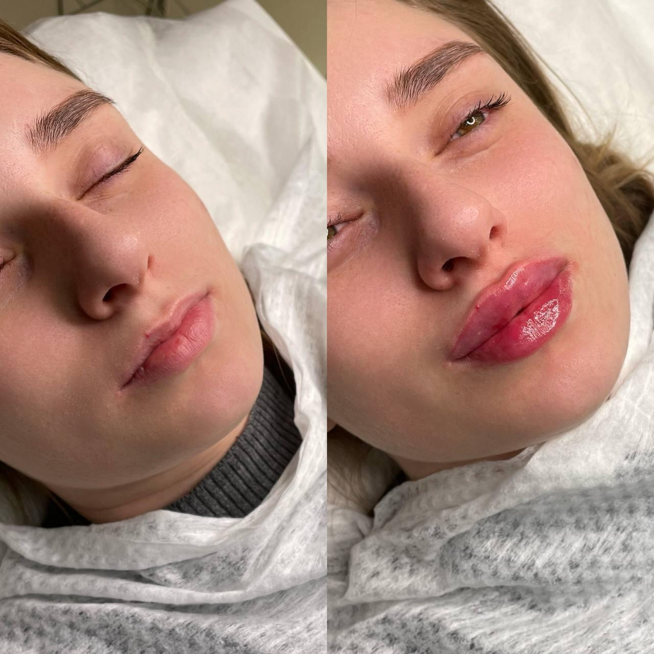 Косметология. Пространство Красоты в Аксае