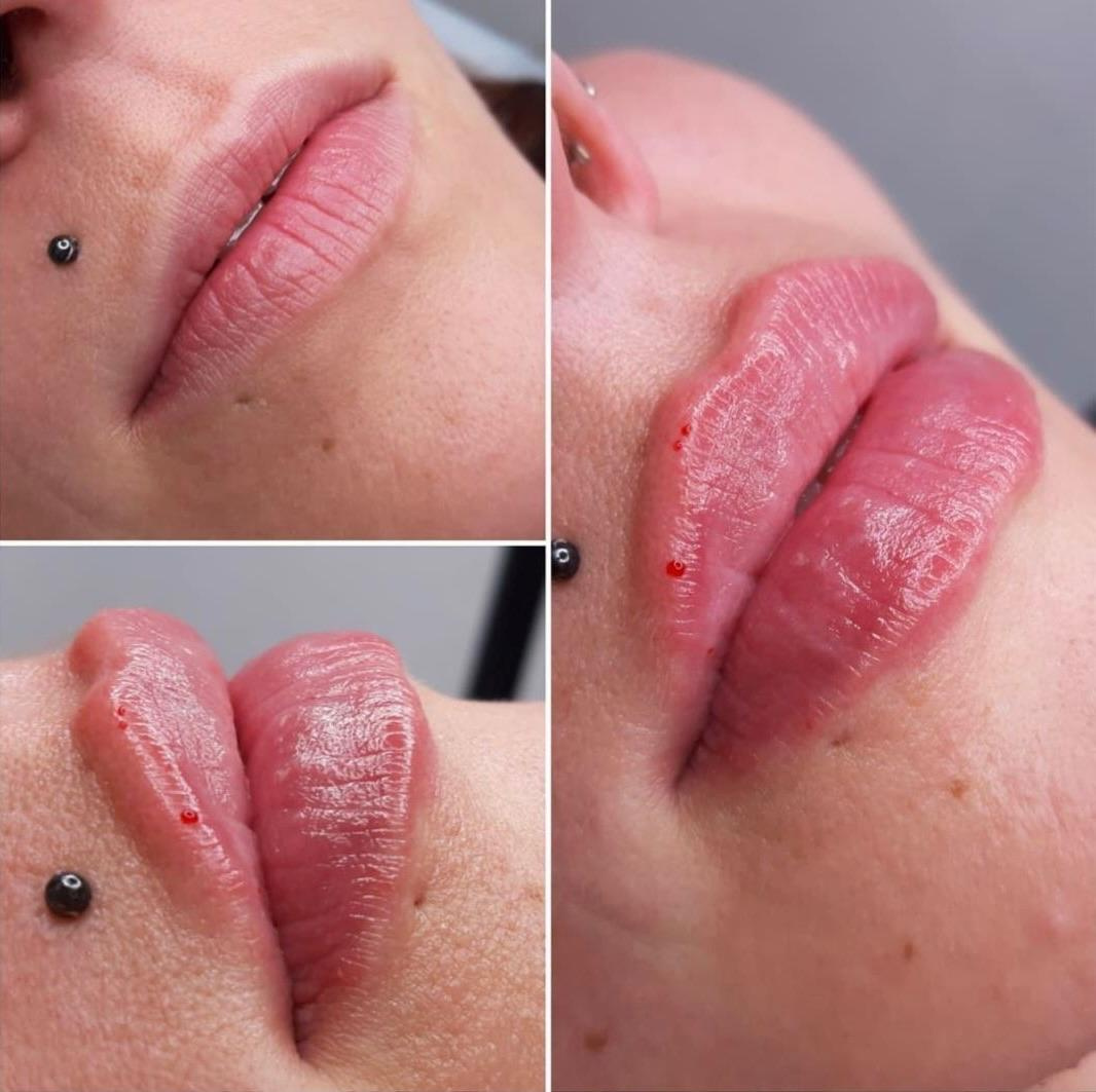 Косметология. Пространство Красоты в Аксае