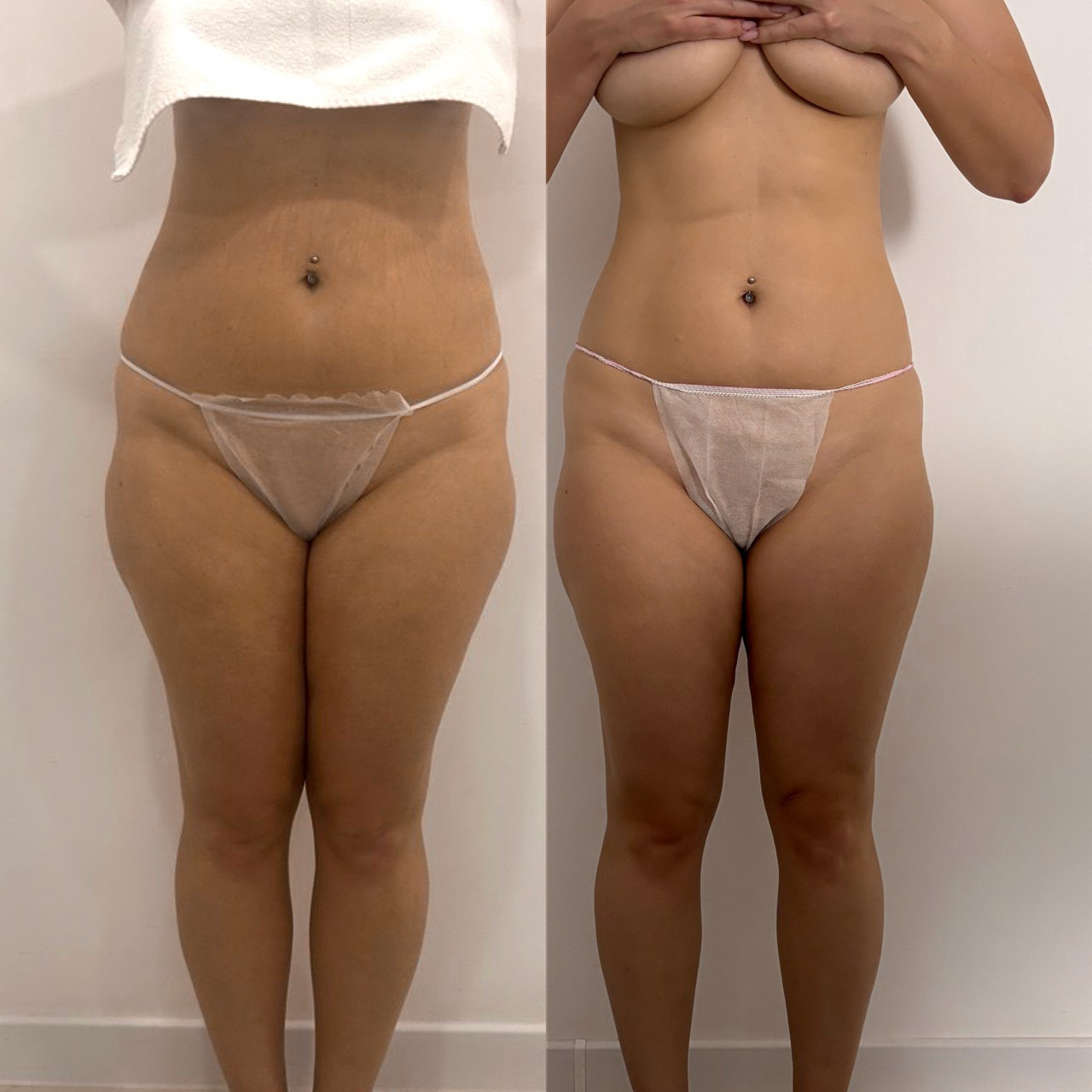 Аппаратный массаж, эндосфера, ручной массаж. Студия перманентного макияжа, косметологии и массажа SYMMETRY в Москве, м. Киевская