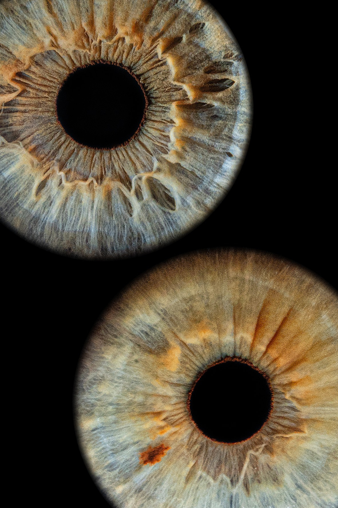 Примеры работ. Мой глаз