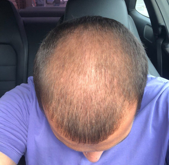 THE CACTUS EFFECT 10/10