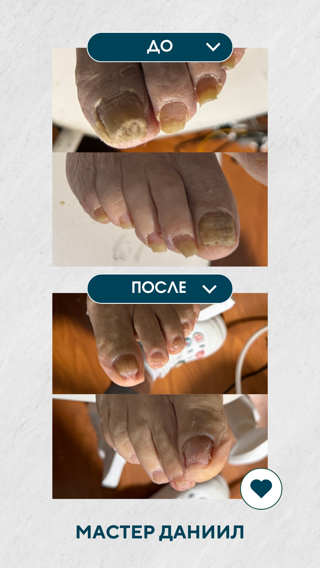 Благотворительный выезд в пансионат. Подолог г. Хабаровск — центр здоровой стопы «FOOTTIME»