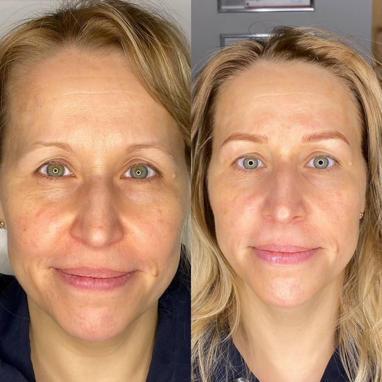 Онлайн обучение волосковой технике гиперреализм. Студия перманентного макияжа, косметологии и массажа SYMMETRY в Москве, м. Киевская