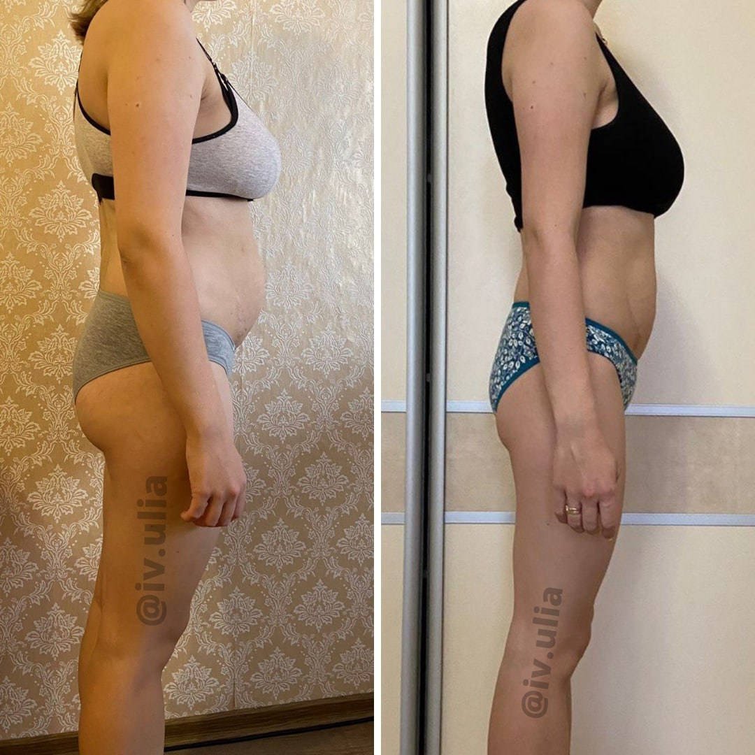 ДО/ПОСЛЕ. Нутрициолог Юлия Великова