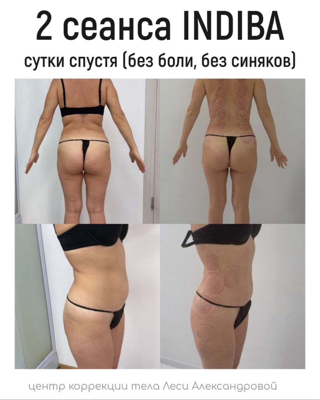 Результаты. Центр Коррекции Тела в городе Чехов