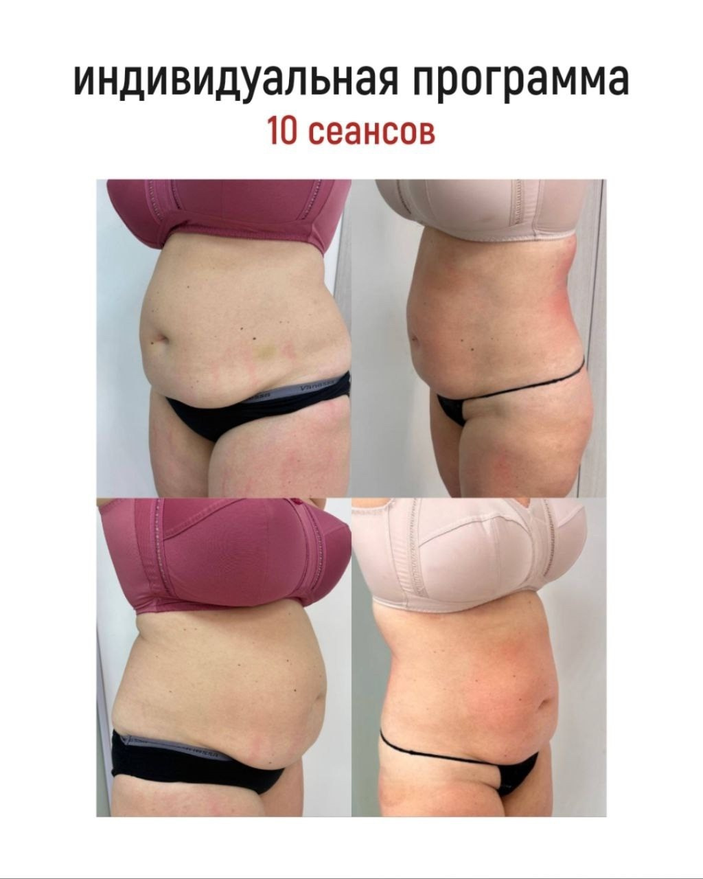 Результаты. Центр Коррекции Тела в городе Чехов