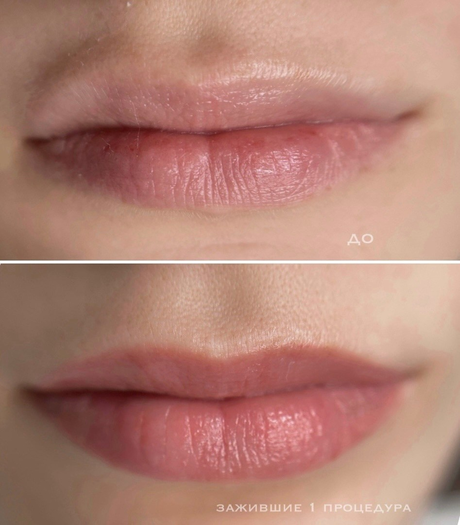 ГУБЫ зажившие. Перманентный макияж и удаление старого татуажа в Ростове-на-Дону Дарья Исакова