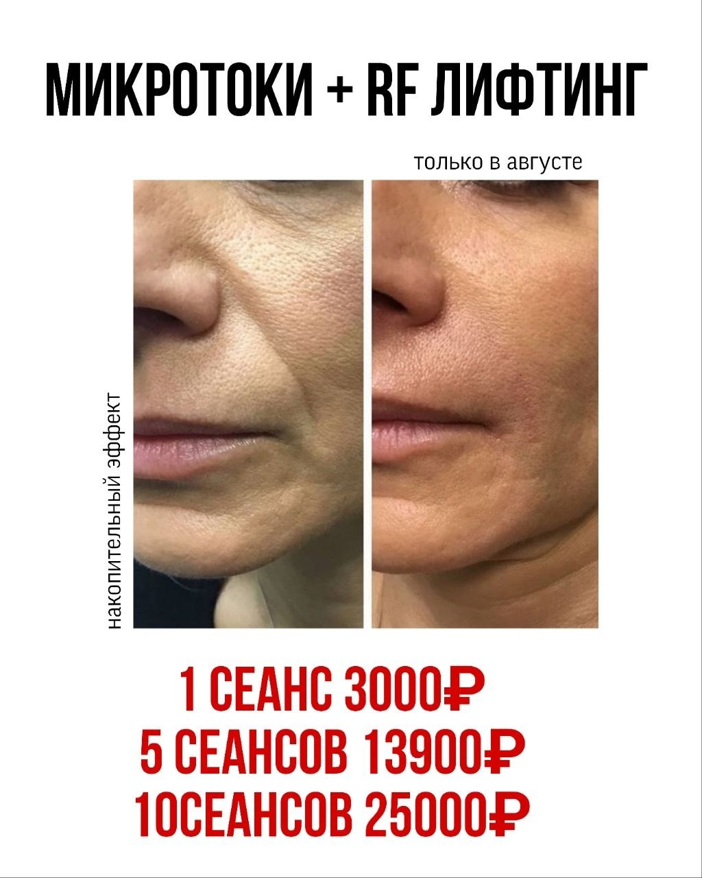 Результаты. Центр Коррекции Тела в городе Чехов