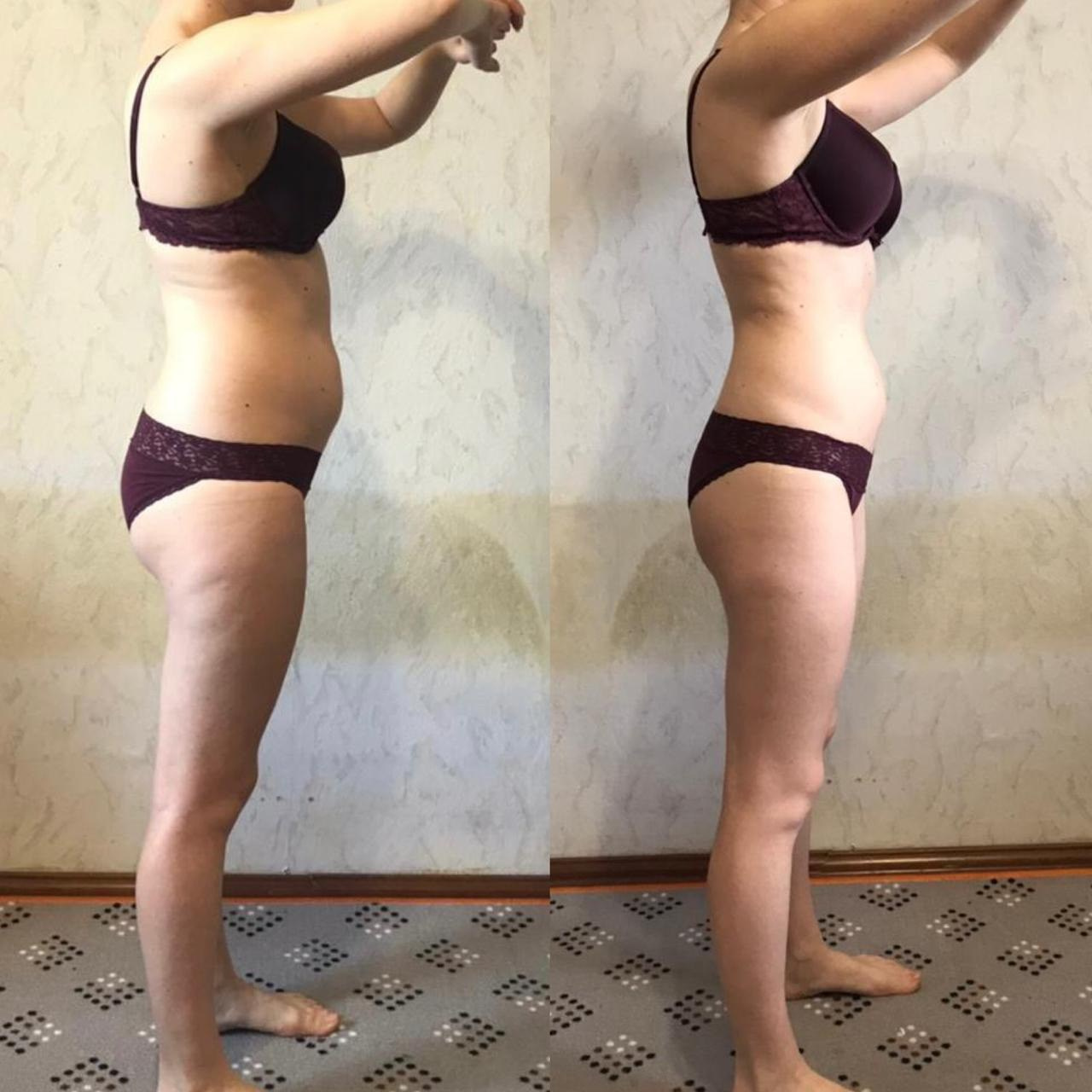 ДО/ПОСЛЕ. Нутрициолог Юлия Великова