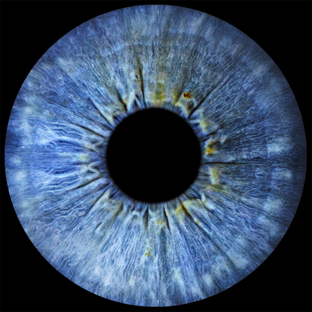 Примеры фото. Фото радужки глаза LOOK IN