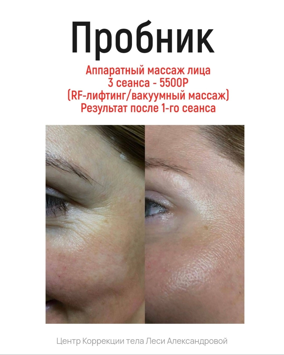 Результаты. Центр Коррекции Тела в городе Чехов