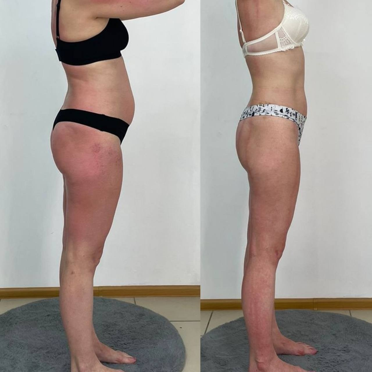 Результаты. Центр Коррекции Тела в городе Чехов