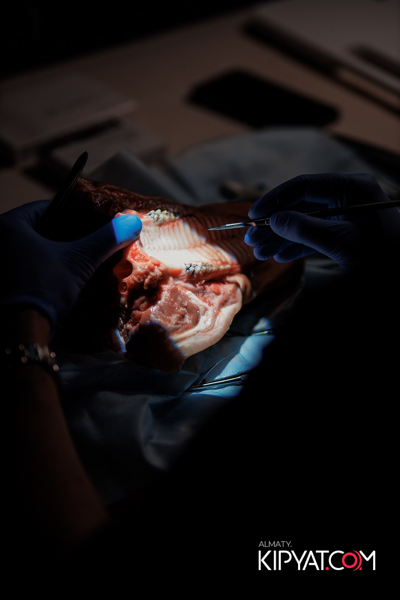 КУРС СТОМАТОЛОГОВ «НКР И ПОСЛЕДУЮЩАЯ РАБОТА С МЯГКИМИ ТКАНЯМИ». КИПЯТКОМ АЛМАТЫ!