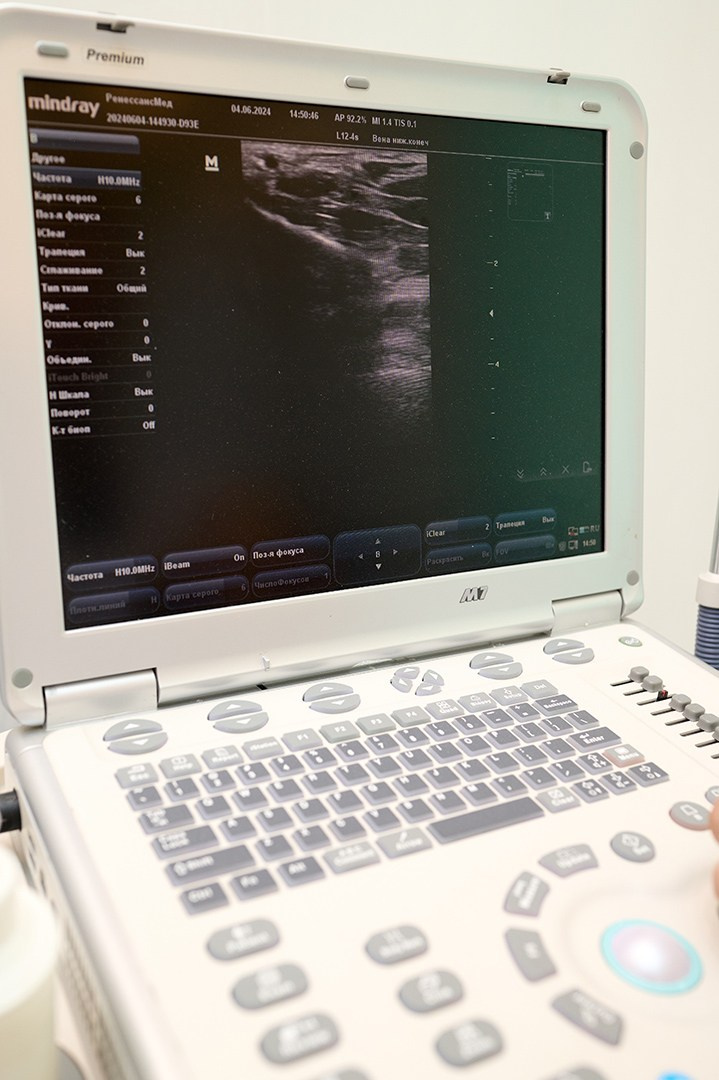 Клиника Варикоза Нет. Репортажный, свадебный, предметный фотограф, Сызрань, Андрей Богатов