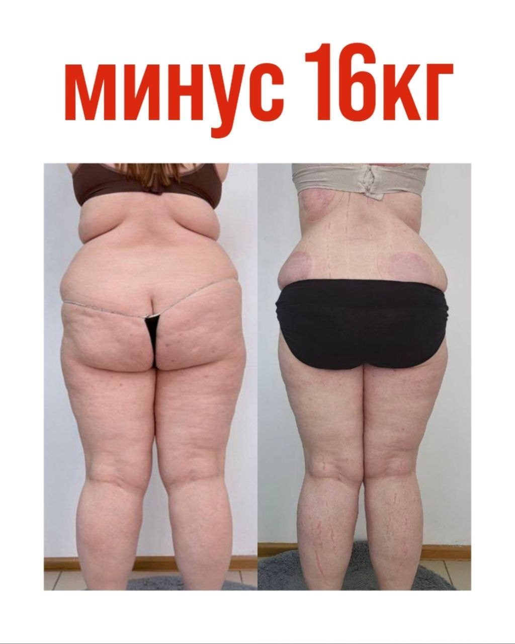 Результаты. Центр Коррекции Тела в городе Чехов