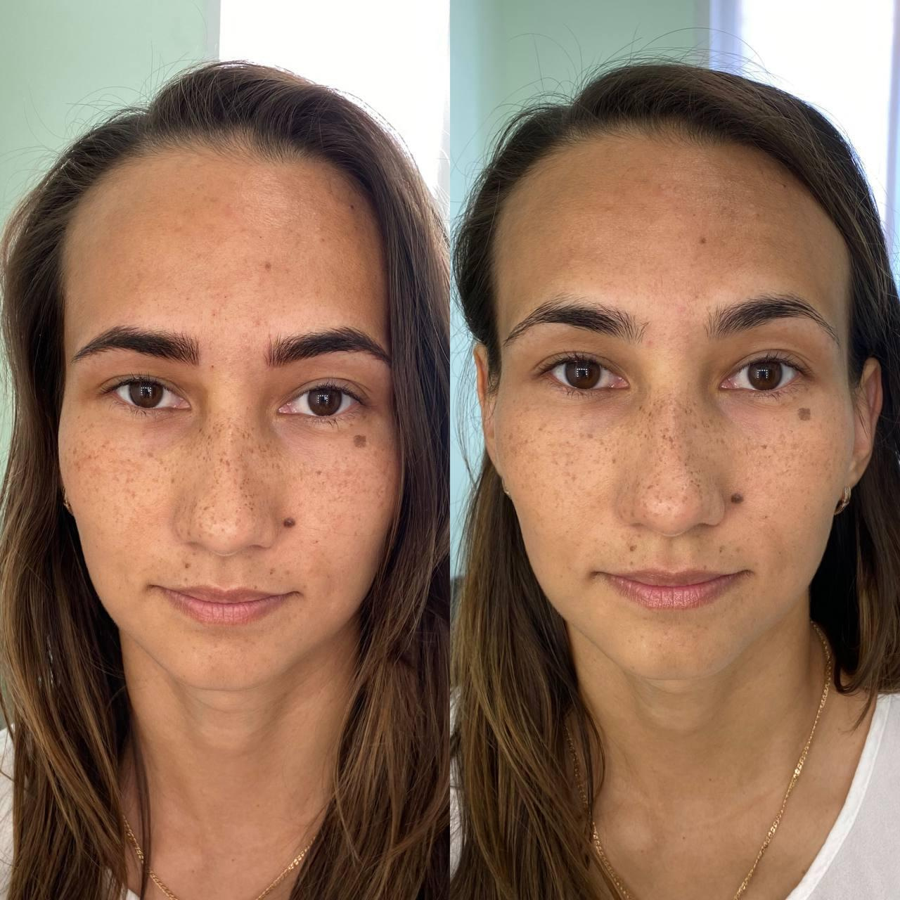 Онлайн обучение волосковой технике гиперреализм. Студия перманентного макияжа, косметологии и массажа SYMMETRY в Москве, м. Киевская