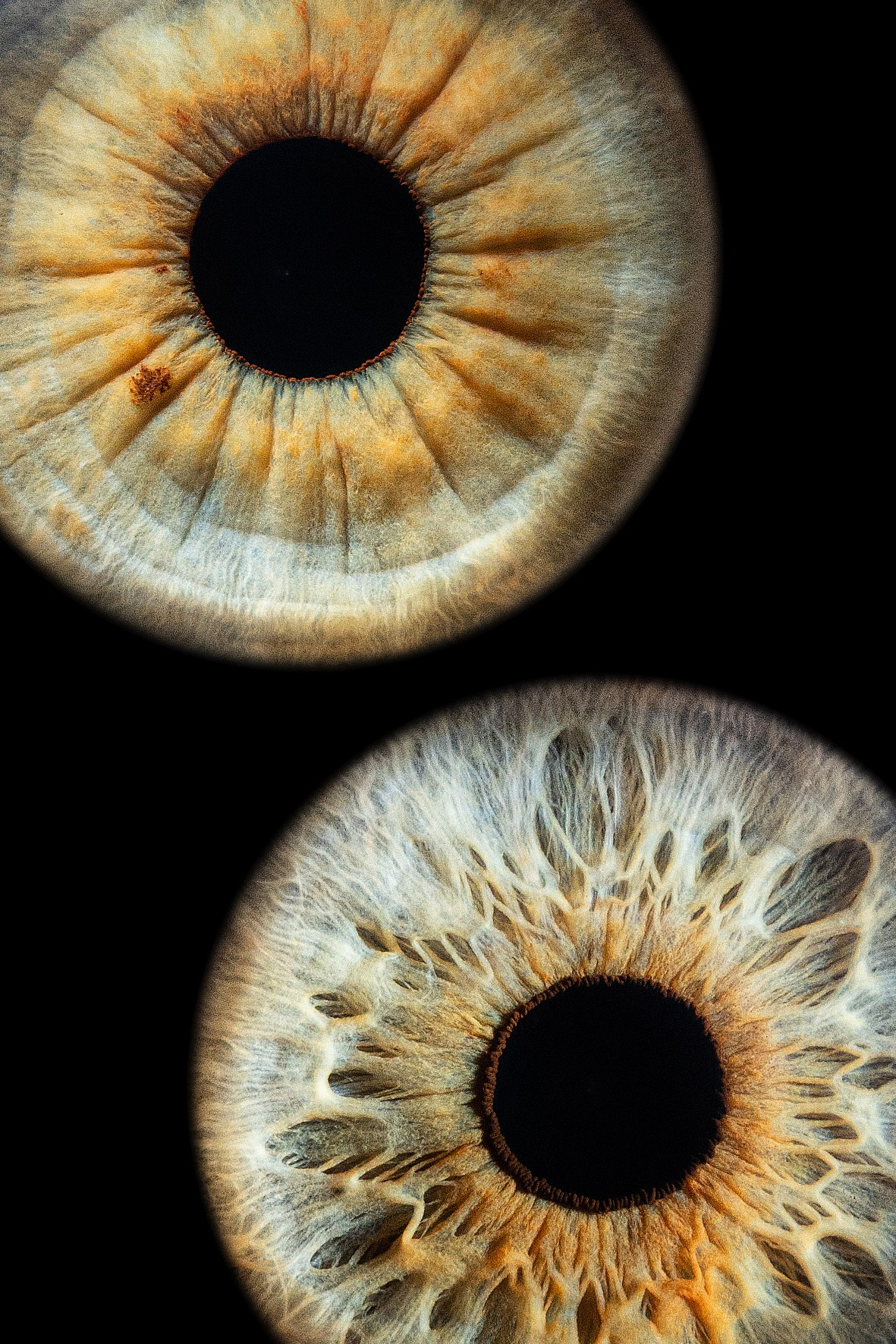 Примеры работ. Мой глаз