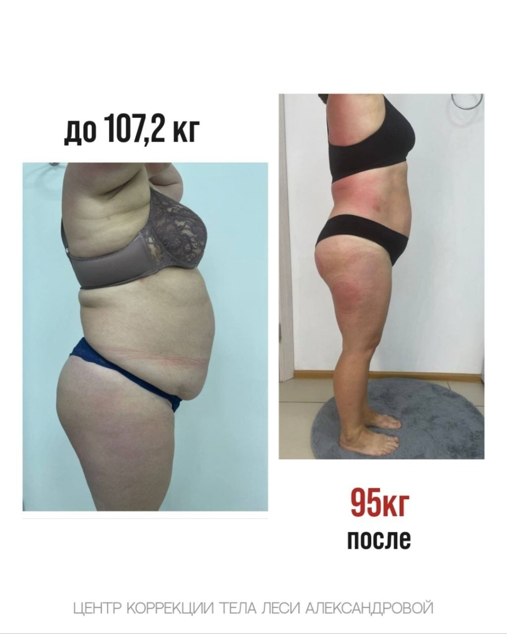 Результаты. Центр Коррекции Тела в городе Чехов