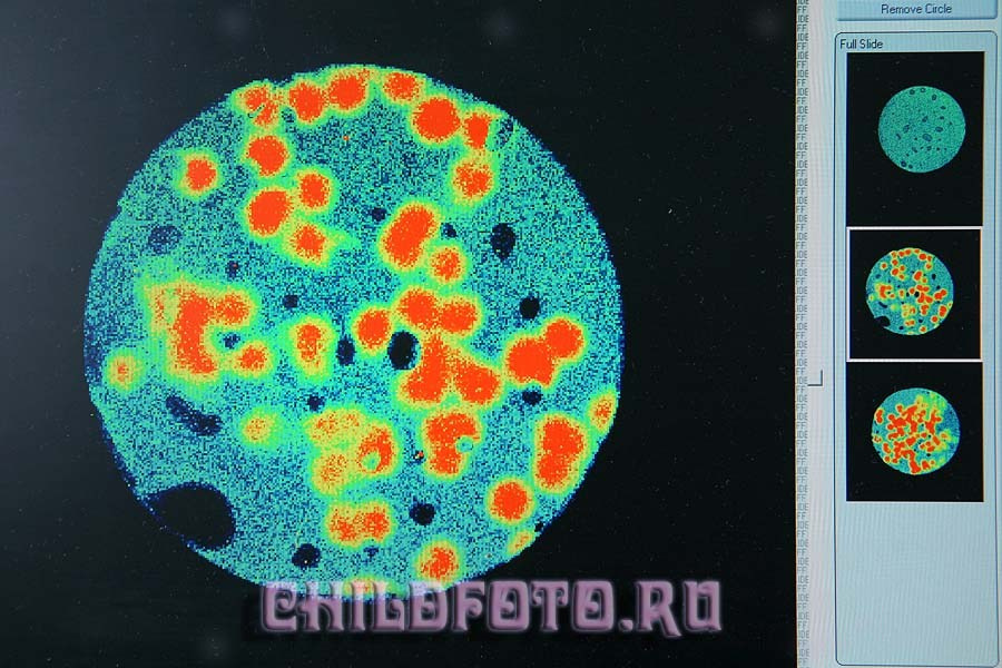 Институт Белка г. Пущино. Skazka.wfolio.pro