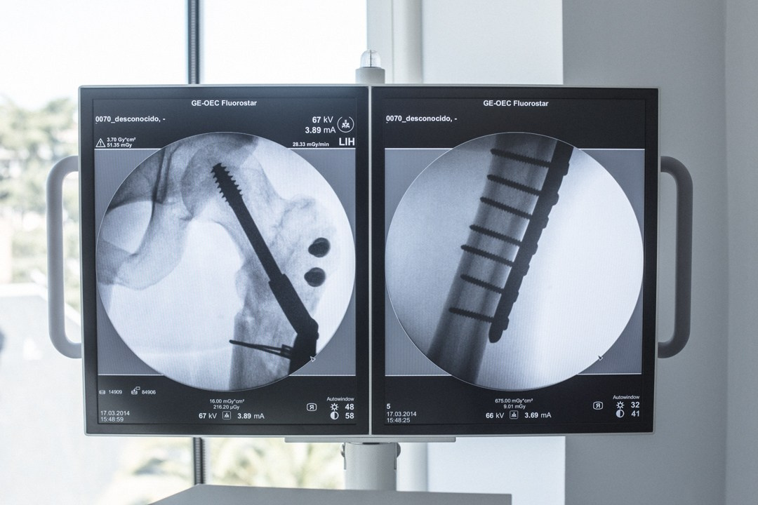 Cherrybomb Pavel Alekhin Doc. Bivol images