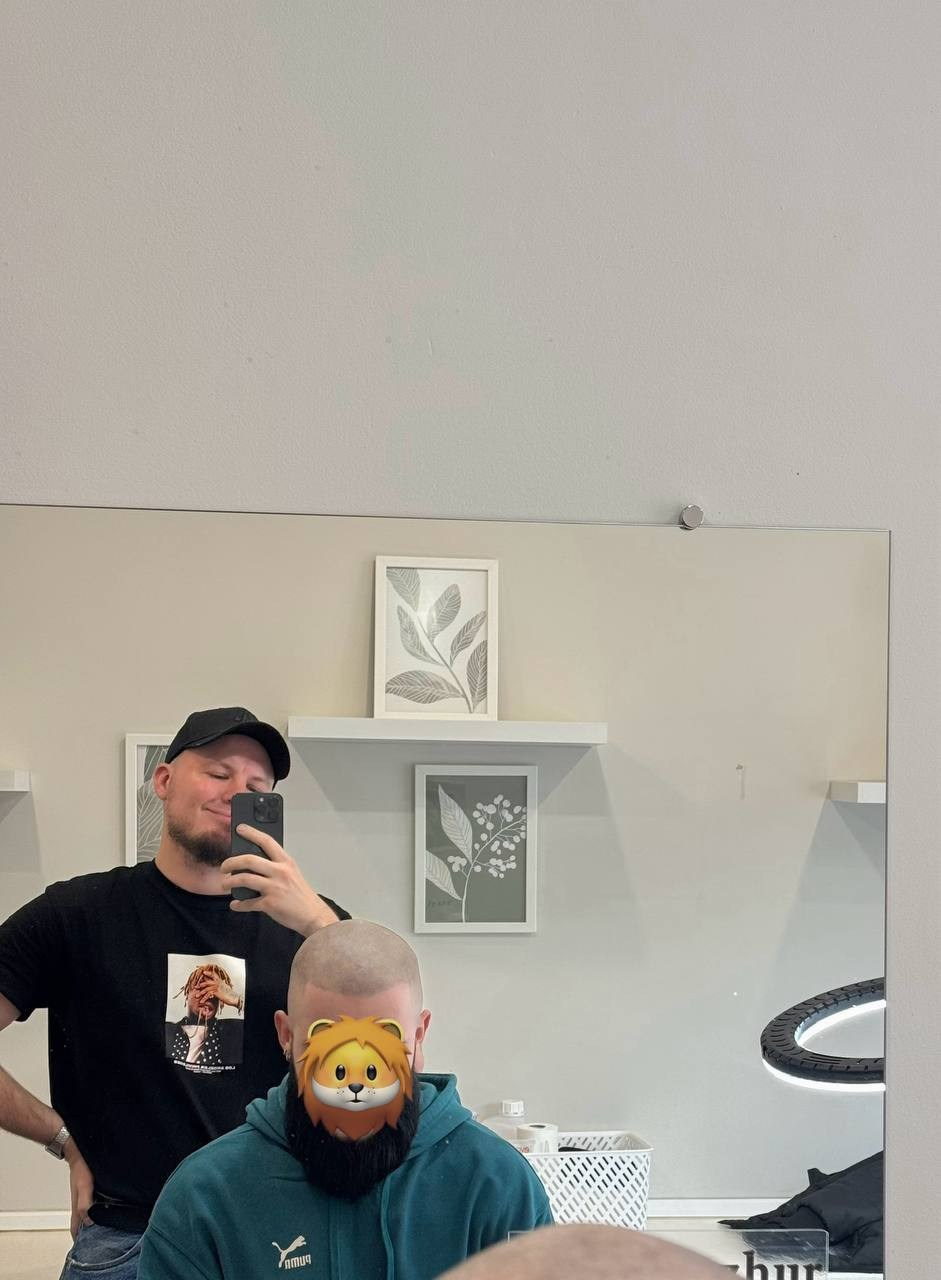 Нажмите на фото что бы открыть. SMP Трихопигментация Воронеж Волгоград Москва Казань Никита Нестеров