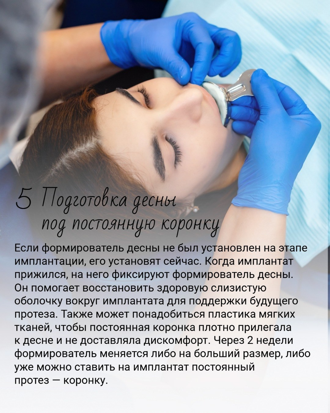 Пост-карусель для стоматологии. AI-дизайнер. Создание контента для онлайн форматов