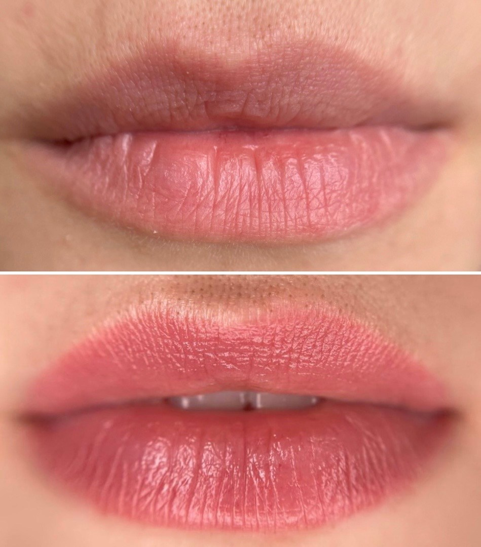 ГУБЫ зажившие. Перманентный макияж и удаление старого татуажа в Ростове-на-Дону Дарья Исакова