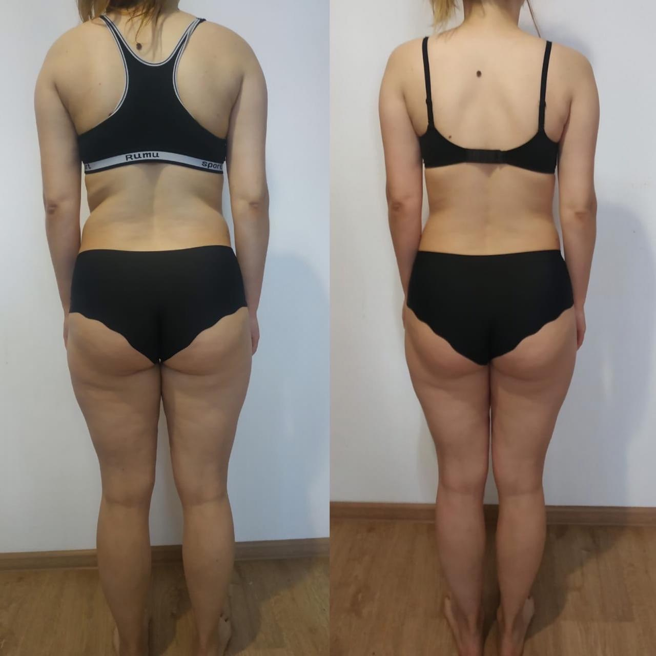 ДО/ПОСЛЕ. Нутрициолог Юлия Великова