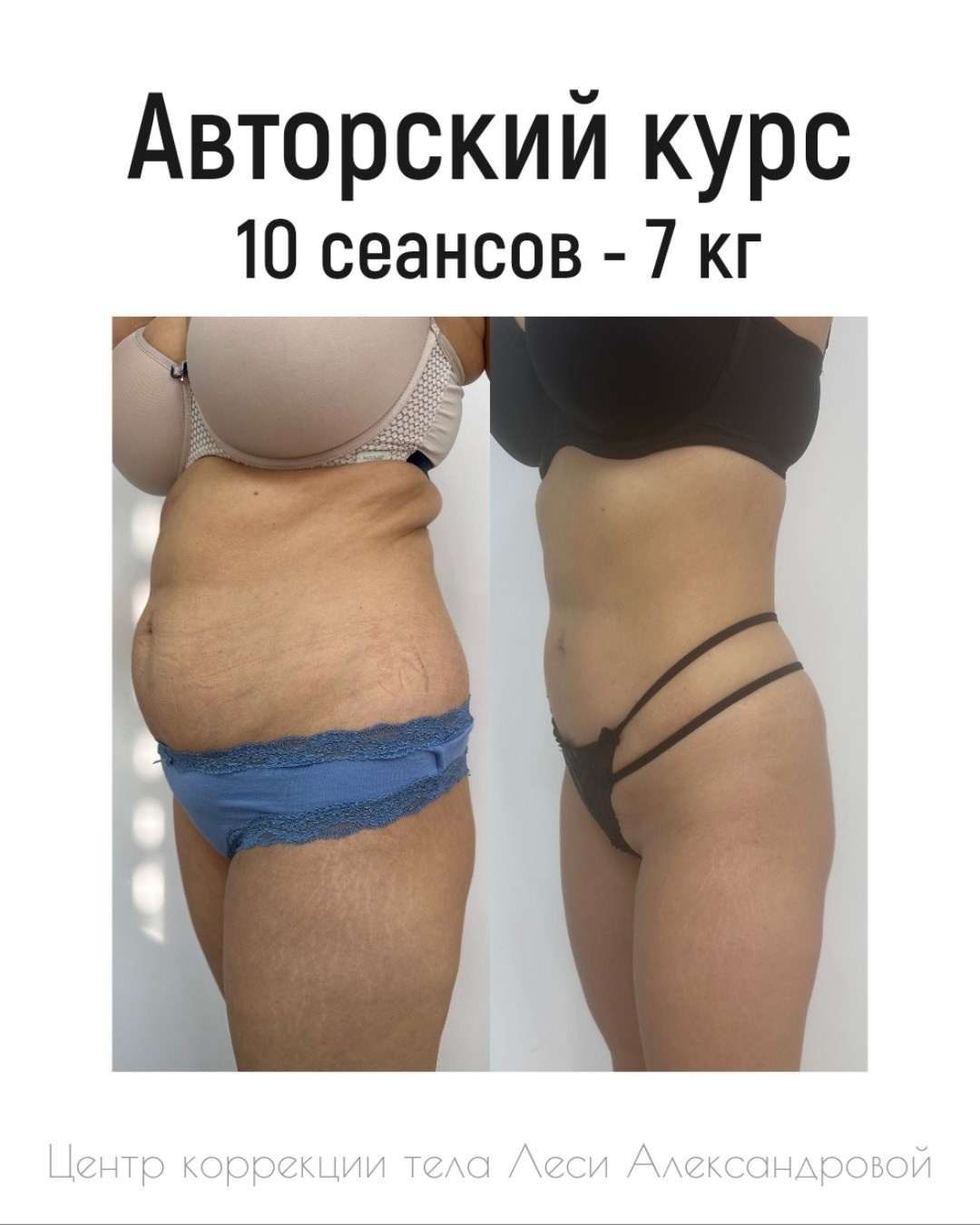 Результаты. Центр Коррекции Тела в городе Чехов