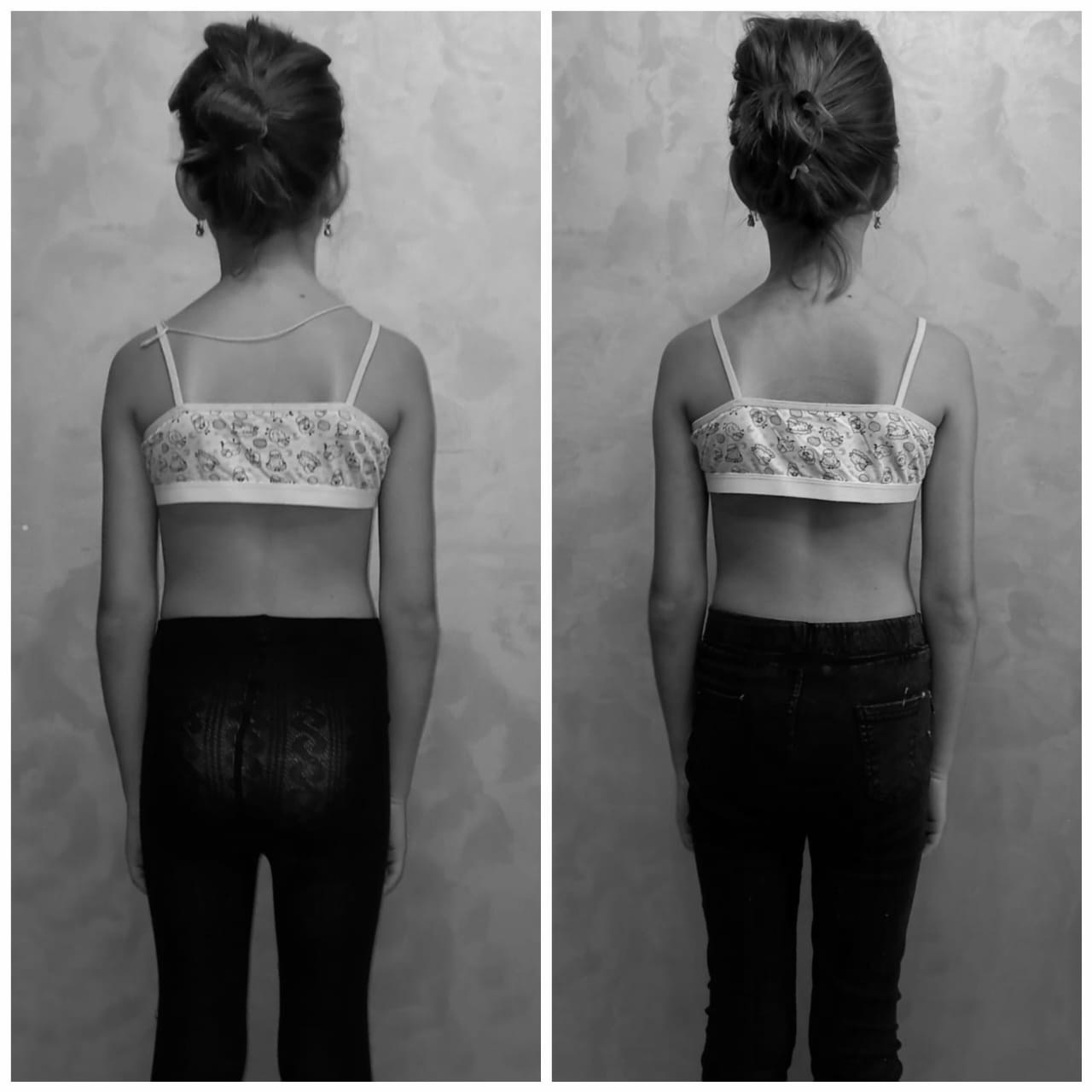 Фото до и после