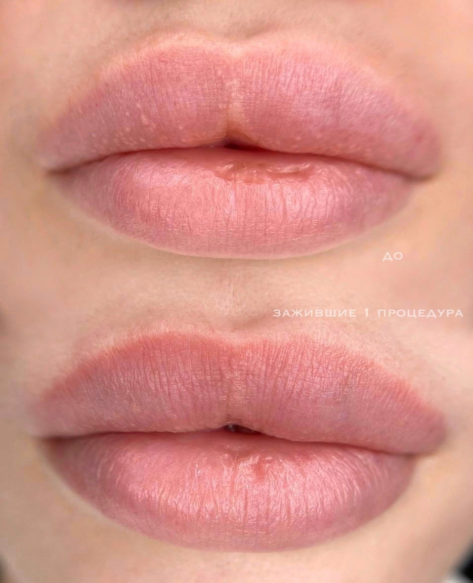 ГУБЫ зажившие. Перманентный макияж и удаление старого татуажа в Ростове-на-Дону Дарья Исакова