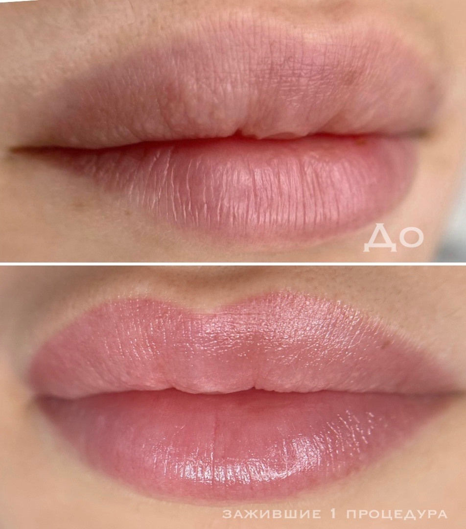ГУБЫ зажившие. Перманентный макияж и удаление старого татуажа в Ростове-на-Дону Дарья Исакова