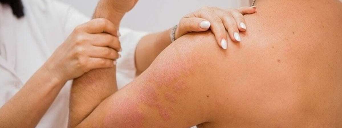 Препараты для лечения кожных заболеваний. «Сово-Сова» продукция для омоложения, здоровья и долголетия