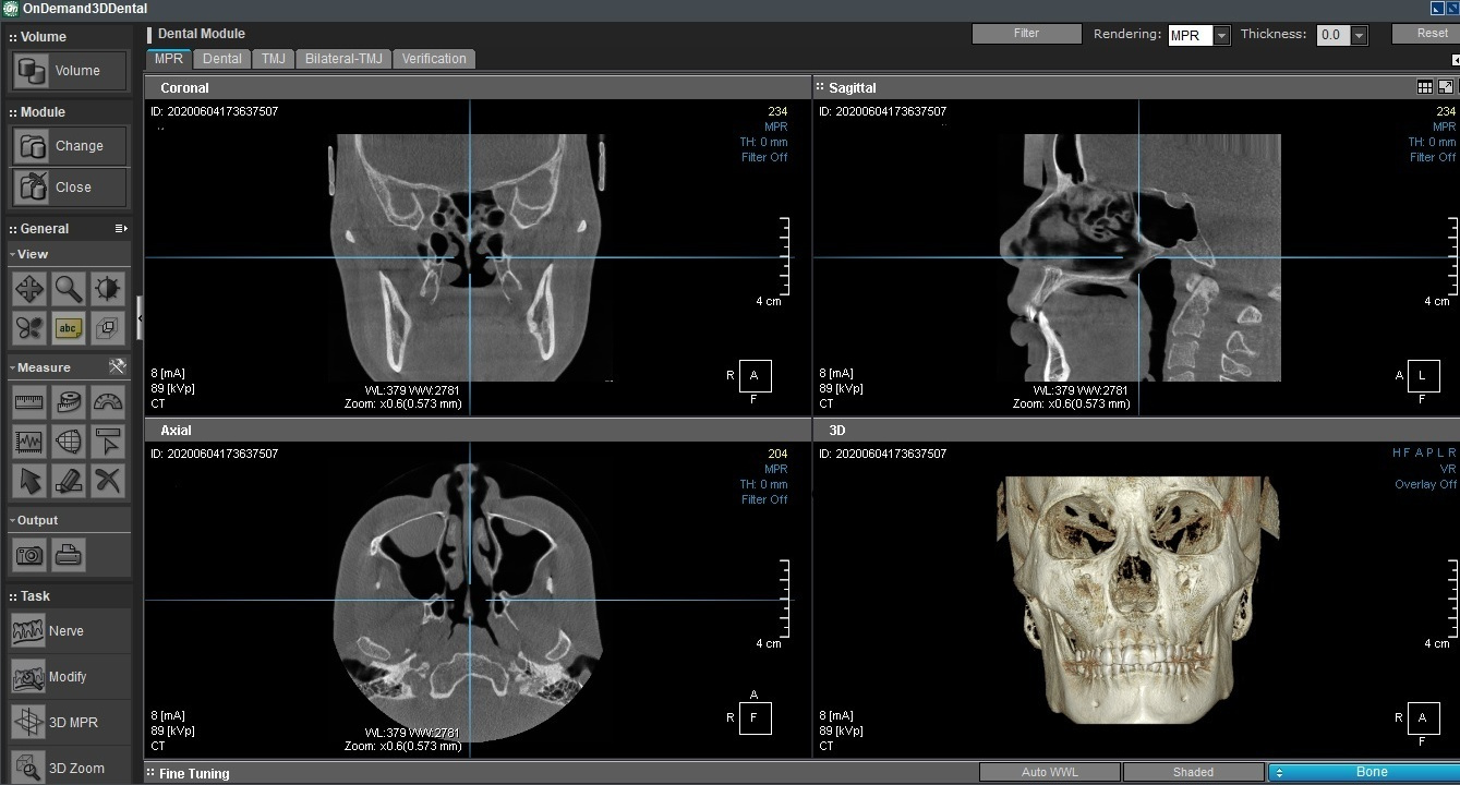 Стоимость диагностики. Стоматология «Ортодонт-Эстетик». Установка брекетов в Оренбурге, взрос