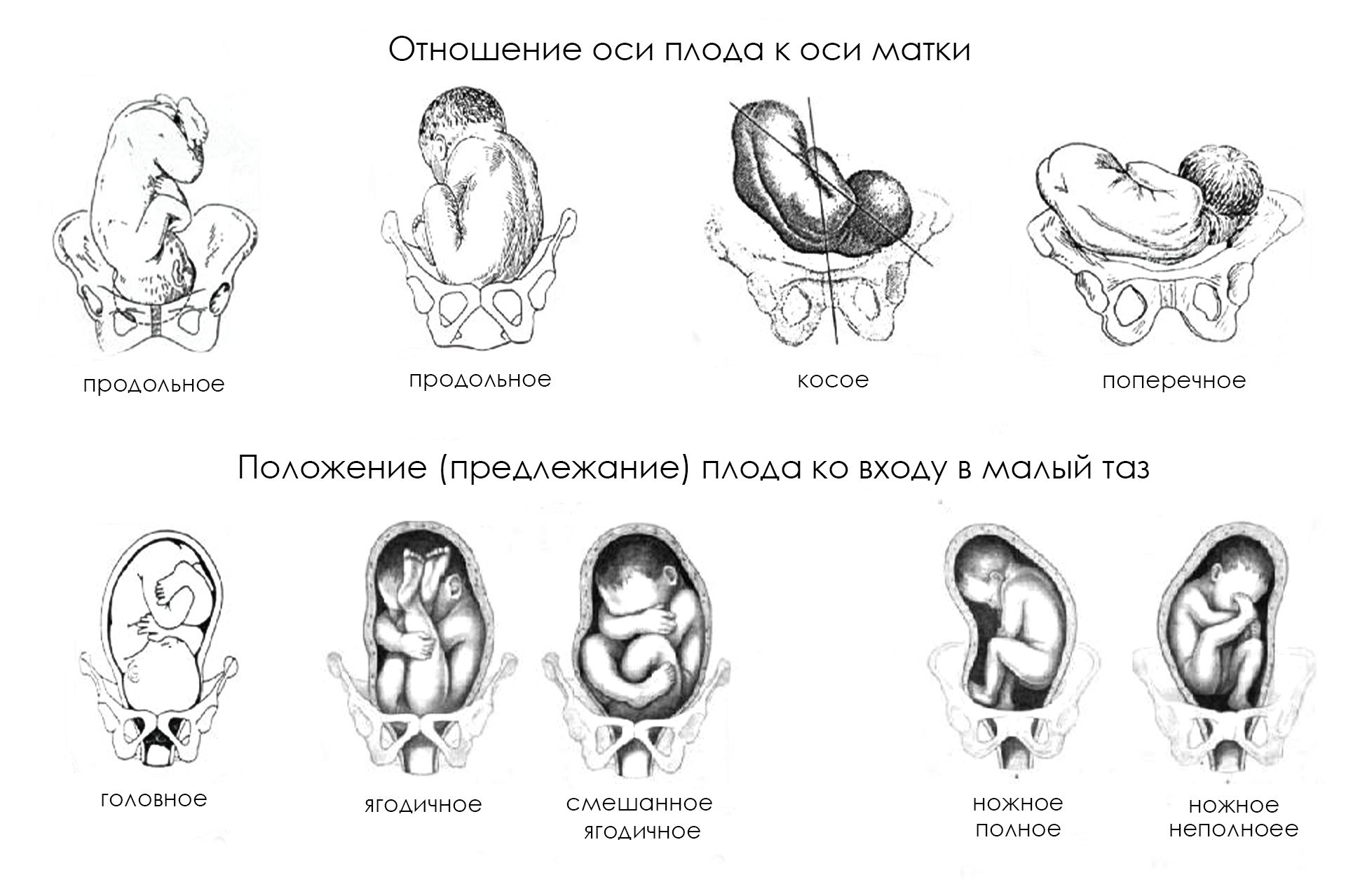 Вопросы и ответы о фотосессии новорожденных. Фотосессия новорожденных в  Москве — newborn фотограф Елена Виниченко