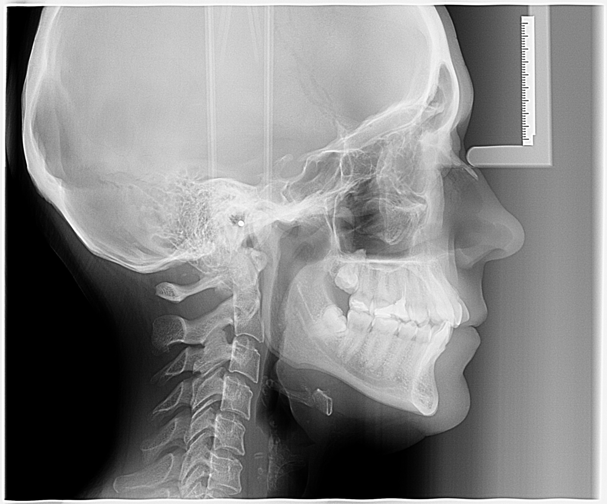 Стоимость диагностики. Стоматология «Ортодонт-Эстетик». Установка брекетов в Оренбурге, взрос