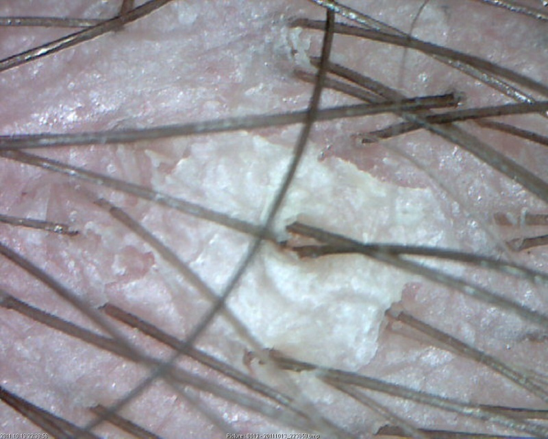 Восстановление волос и кожи головы от 500 р. Пилинг кожи головы, от м. Парикмахер-стилист-колорист Соколова Ольга г. Дзержинск