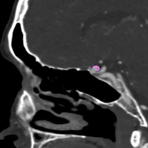 Бусы могут быть не только на шее, но и внутри нее. РЕНТГЕН КТ МРТ в Санкт-Петербурге Александра Лоншакова