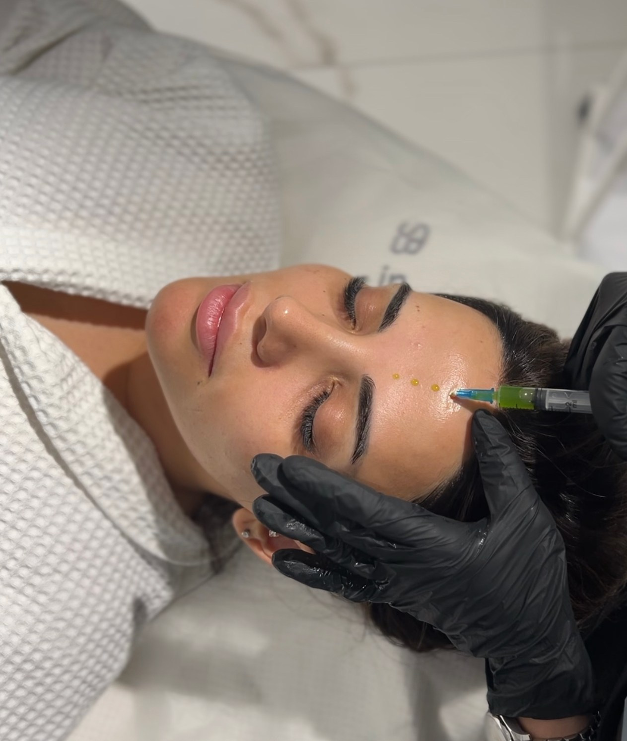 Инъекционная косметология. Студия перманентного макияжа, косметологии и массажа SYMMETRY в Москве, м. Киевская