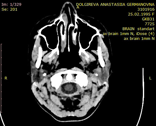 Проект ⠝⠁⠎⠞⠫