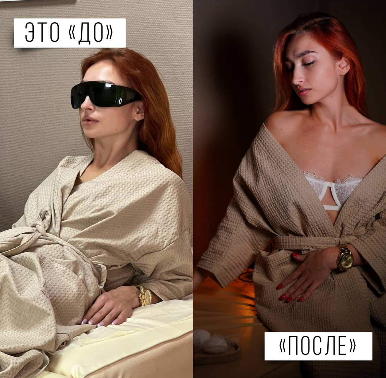 ДО/ПОСЛЕ (примеры визуала)